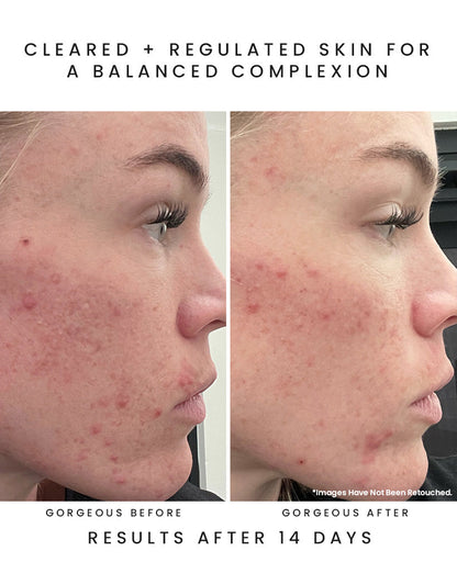 AURORA Superfood Clarity Concentrate