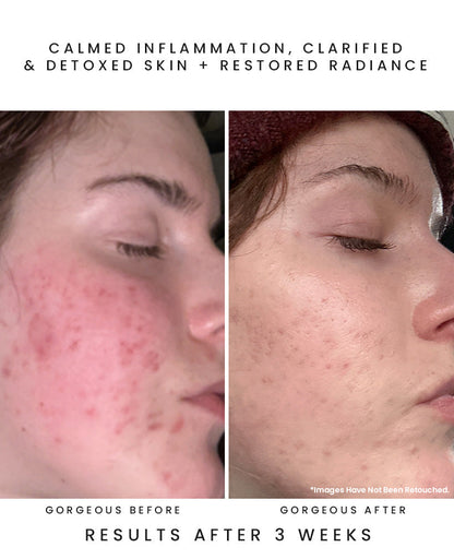 OBSCURA Night Repair Concentrate