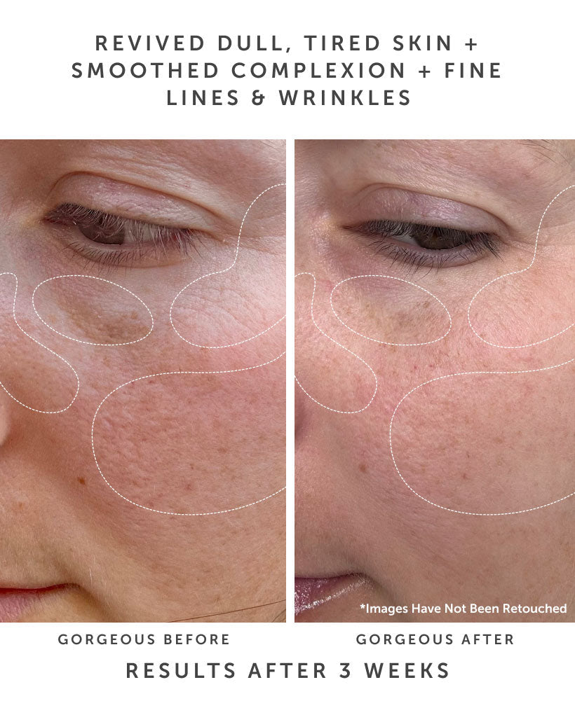 ANCHOR Bio-Retinol Youth Serum