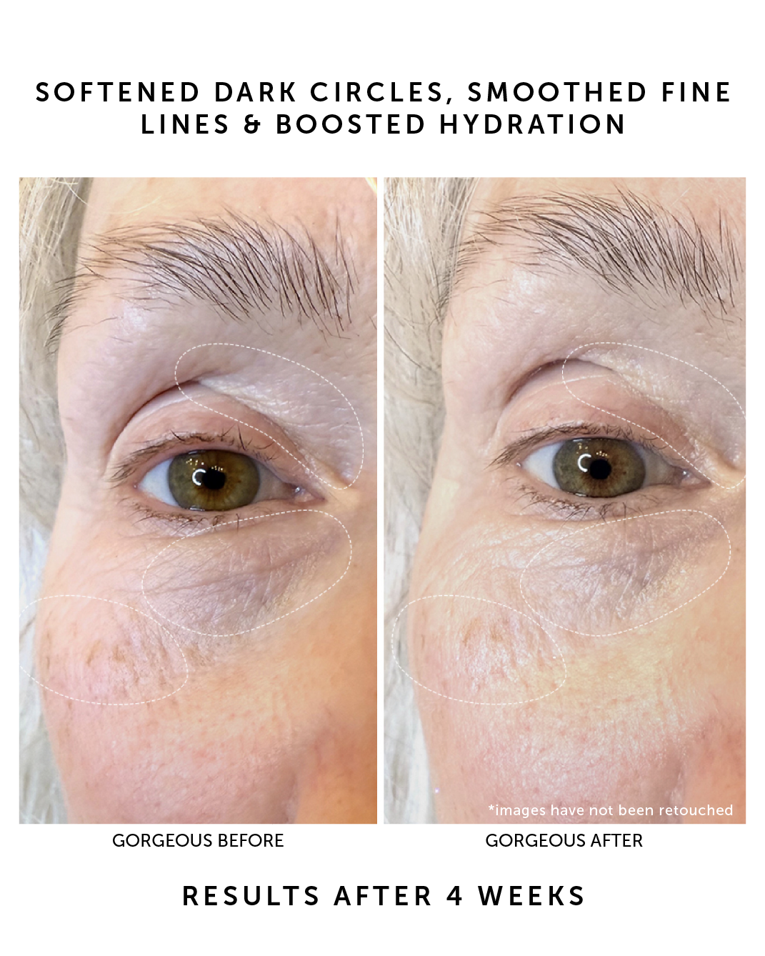 ISLA Bio-Retinol Youth Eye Serum